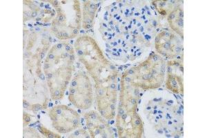 Immunohistochemistry of paraffin-embedded Rat kidney using GFER Polyclonal Antibody at dilution of 1:100 (40x lens). (GFER 抗体)