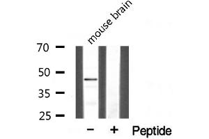 Western blot analysis of extracts from mouse brain, using CLN5 antibody. (CLN5 抗体  (Internal Region))