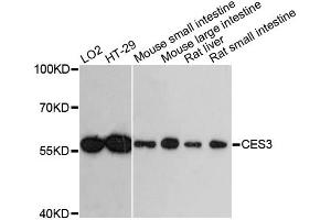 Western blot analysis of extracts of various cell lines, using CES3 antibody. (CES3 抗体)
