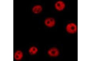 ABIN6279426 staining  HeLa cells by IF/ICC. (KHSRP 抗体  (N-Term))