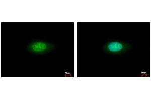 ICC/IF Image Annexin VII antibody detects ANXA7 protein at cytoplasm and nucleus by immunofluorescent analysis. (Annexin VII 抗体)