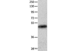 Western blot analysis of Human colon cancer tissue, using KRT23 Polyclonal Antibody at dilution of 1:100 (KRT23 抗体)