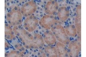 Immunohistochemistry (IHC) image for anti-Protease, serine, 2 (Trypsin 2) (PRSS2) (AA 29-240) antibody (ABIN7441880)