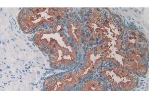 Detection of 0 in Human Prostate Tissue using Monoclonal Antibody to Amylin (Amylin/DAP 抗体)
