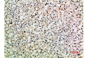 Immunohistochemical analysis of paraffin-embedded human-liver, antibody was diluted at 1:200 (C-Type Lectin Domain Family 4, Member M (CLEC4M) (AA 271-320) 抗体)