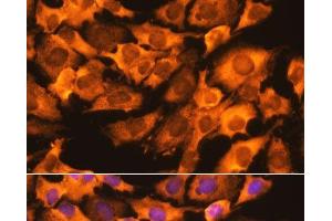 Immunofluorescence analysis of C6 cells using RPS3 Polyclonal Antibody at dilution of 1:100. (RPS3 抗体)