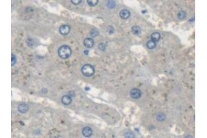 Immunohistochemistry (IHC) image for anti-Signal Transducing Adaptor Molecule (SH3 Domain and ITAM Motif) 2 (STAM2) (AA 1-377) antibody (ABIN7444217)