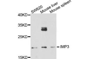 Western blot analysis of extract of various cells, using IMP3 antibody. (IMP3 抗体)