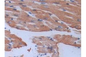 Detection of MYL3 in Mouse Cardiac Muscle Tissue using Polyclonal Antibody to Myosin Light Chain 3, Alkali, Ventricular, Slow Skeletal (MYL3) (MYL3/CMLC1 抗体  (AA 8-199))