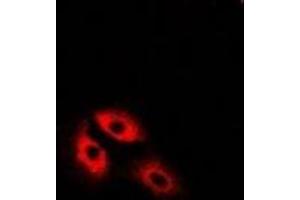 Immunofluorescent analysis of MDH2 staining in U2OS cells.