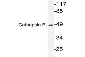 Western blot (WB) analysis of Cathepsin E antibody in extracts from HUVECcells. (Cathepsin E 抗体)