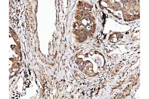 IHC analysis of Angiogenin/ANG using anti-Angiogenin/ANG antibody (ABIN4886457). (ANG 抗体  (AA 25-147))