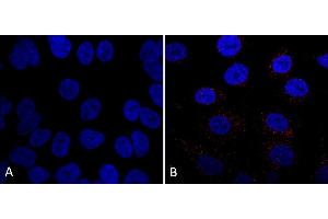Immunocytochemistry/Immunofluorescence analysis using Mouse Anti-VPS35 Monoclonal Antibody, Clone 7E4 (ABIN6932909). (VPS35 抗体  (Atto 390))