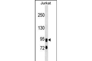 FIG4 Antibody (C-term) (ABIN1537627 and ABIN2849648) western blot analysis in Jurkat cell line lysates (35 μg/lane). (FIG4 抗体  (C-Term))