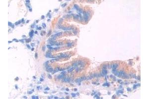 Immunohistochemistry (IHC) image for anti-Lecithin-Cholesterol Acyltransferase (LCAT) (AA 41-210) antibody (ABIN7436696)