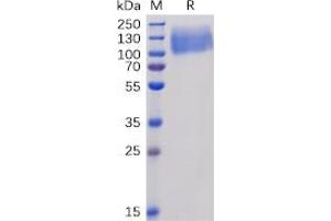 Human CEACAM5 Protein, His Tag on SDS-PAGE under reducing condition. (CEACAM5 Protein (His tag))