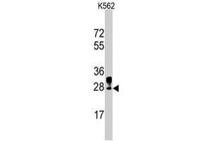 Western blot analysis of ERAS polyclonal antibody  in K-562 cell line lysates (35 ug/lane). (ERAS 抗体  (N-Term))