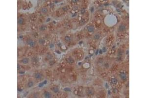 IHC-P analysis of Human Tissue, with DAB staining. (SMPD1 抗体  (AA 319-579))