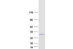 Western Blotting (WB) image for Myosin Light Chain 4, Alkali, Atrial, Embryonic (MYL4) (Transcript Variant 1) protein (Myc-DYKDDDDK Tag) (ABIN2726669)
