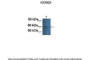 Lanes:   100 ug CHO cell lysate  Primary Antibody Dilution:   1:1000  Secondary Antibody:   Goat anti-rabbit HRP  Secondary Antibody Dilution:   1:25000  Gene Name:   KCNQ1  Submitted by:   Anonymous (KCNQ1 抗体  (N-Term))