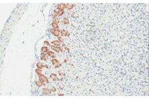 Immunohistochemistry (IHC) image for anti-TLR4 /MD2 Complex antibody (ABIN2665419) (TLR4 /MD2 Complex 抗体)