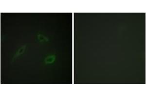 Immunofluorescence analysis of HeLa cells, using CD4 (Ab-433) Antibody. (CD4 抗体  (AA 401-450))