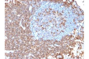 Formalin-fixed, paraffin-embedded human Lymph Node stained with CD43 Mouse Recombinant Monoclonal Antibody (rSPN/839). (Recombinant CD43 抗体)