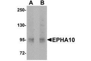 Western blot analysis of EphA10 in 293 cell lysate with AP30318PU-N EphA10 antibody at (A) 1 μg/ml and (B) 2 μg/ml. (EPH Receptor A10 抗体  (N-Term))