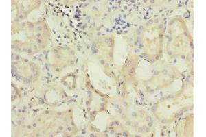 Immunohistochemistry of paraffin-embedded human kidney tissue using ABIN7175029 at dilution of 1:100 (C5ORF22 抗体  (AA 101-420))