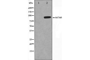 Western blot analysis on HepG2 cell lysate using MCM5 Antibody. (MCM5 抗体  (N-Term))