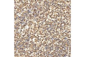 IHC analysis of Citrin/SLC25A13 using anti-Citrin/SLC25A13 antibody (ABIN7599512). (slc25a13 抗体  (AA 1-643))