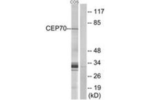 Western blot analysis of extracts from COS cells, using CEP70 Antibody. (CEP70 抗体  (AA 241-290))