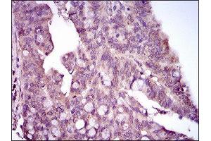 Immunohistochemistry (IHC) image for anti-Mitogen-Activated Protein Kinase 14 (MAPK14) (AA 299-360) antibody (ABIN1845584) (MAPK14 抗体  (AA 299-360))