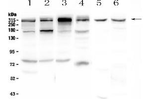 Western blot analysis of IGF2R using anti-IGF2R antibody . (IGF2R 抗体  (AA 424-529))