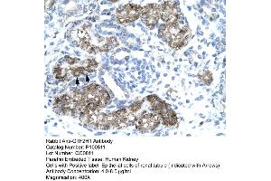 Immunohistochemistry (IHC) image for anti-General Transcription Factor IIH, Polypeptide 1, 62kDa (GTF2H1) (N-Term) antibody (ABIN2792595)