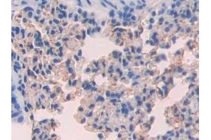 Detection of CD15 in Mouse Lung Tissue using Polyclonal Antibody to Cluster Of Differentiation 15 (CD15)