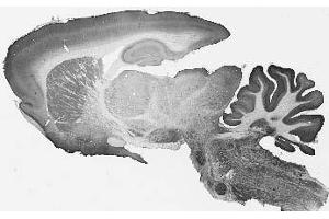 Adult rat brain immunohistochemistry. (TMEM91 抗体  (Cytosolic, N-Term))