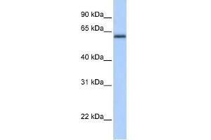Western Blot showing ZBTB26 antibody used at a concentration of 1-2 ug/ml to detect its target protein. (ZBTB26 抗体  (C-Term))