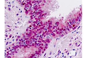 Anti-MAT / MAT1A antibody IHC staining of human lung. (MAT1A 抗体  (AA 107-136))