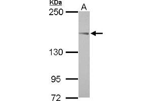 Image no. 1 for anti-ABI Family, Member 3 (NESH) Binding Protein (ABI3BP) (AA 704-903) antibody (ABIN1496391) (ABI3BP 抗体  (AA 704-903))