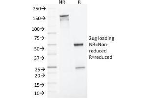 SDS-PAGE Analysis Purified MLH1 Mouse Monoclonal Antibody (MLH1/1324). (MLH1 抗体)