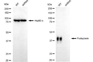 Western blotting analysis using podoplanin antibody (ABIN7799860). (Recombinant Podoplanin 抗体)