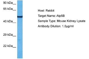Western Blotting (WB) image for anti-ATP Synthase, H+ Transporting, Mitochondrial F1 Complex, beta Polypeptide (ATP5B) (N-Term) antibody (ABIN2783268)