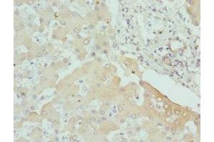 Immunohistochemistry of paraffin-embedded human liver tissue using ABIN7146779 at dilution of 1:100 (CPN1 抗体  (AA 209-458))