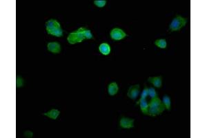 Immunofluorescence staining of MCF-7 cells with ABIN7150805 at 1:266, counter-stained with DAPI. (Dynamitin 抗体  (AA 1-252))