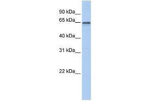 WB Suggested Anti-AHCYL1 Antibody Titration: 0. (AHCYL1 抗体  (N-Term))