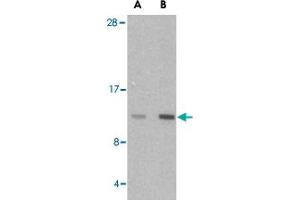 Western blot analysis of HRK in mouse pancreas tissue lysate with HRK polyclonal antibody  at (A) 2. (HRK 抗体  (Internal Region))