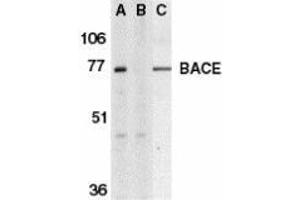 Western blot analysis of BACE in human brain tissue lysate in the absence (A) or presence (B) of blocking peptide and in mouse 3T3 cell lysate (C) with AP30111PU-N BACE antibody at 1 μg/ml. (BACE1 抗体  (C-Term))