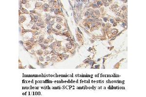 Image no. 1 for anti-Sterol Carrier Protein 2 (SCP2) antibody (ABIN791185) (SCP2 抗体)