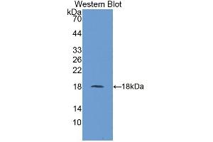 Detection of Recombinant UBE2I, Human using Polyclonal Antibody to Ubiquitin Conjugating Enzyme E2I (UBE2I) (UBE2I 抗体  (AA 33-158))